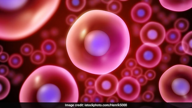 World Sickle Cell Disease: Sickle Cell Anaemia can cause of loss of red blood cells