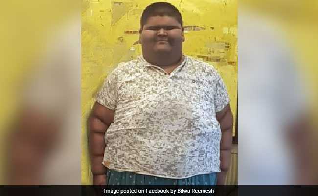 At 236 Kg, Delhi Boy Was "World's Heaviest Teen" Before Surgery
