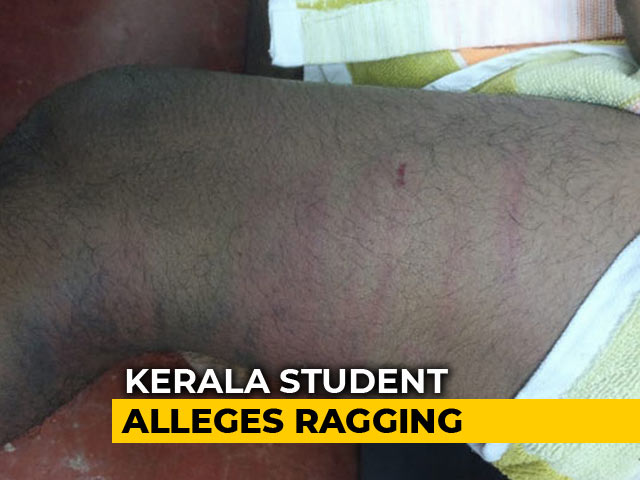 "Beaten By Seniors For 3 Hours," Says Kerala Student From Hospital Bed