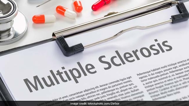 Symptoms of Multiple sclerosis include vision loss, pain, fatigue and impaired coordination