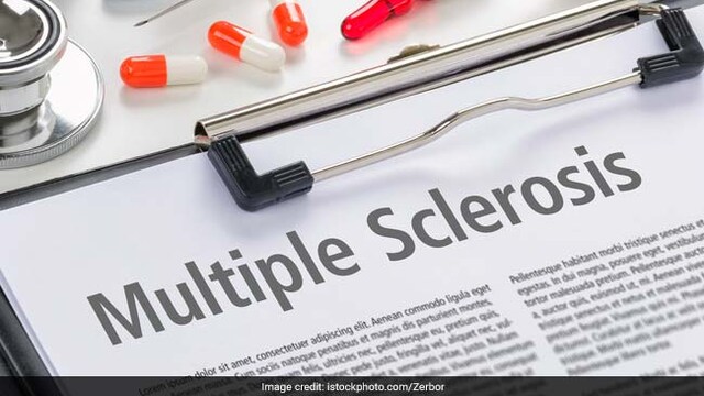Symptoms of Multiple sclerosis include vision loss, pain, fatigue and impaired coordination