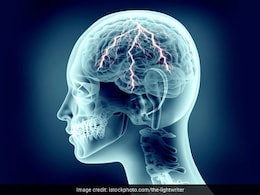 नर्वस सिस्टम से रिलेटेड डिसऑर्डर का पता लगाएगा अब ये नया एआई टूल : स्टडी