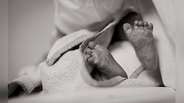 2 Fetuses Successfully Removed From Newborn's Abdomen In Maharashtra