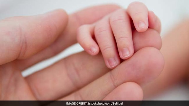 Cradle cap is a common rash seen in newborns