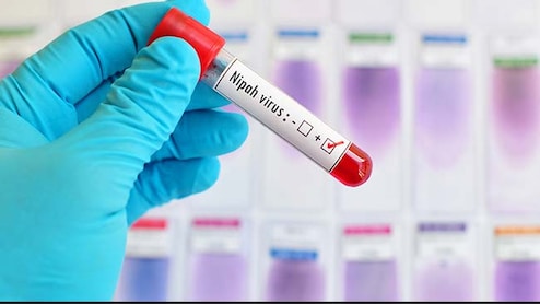 पश्चिम बंगाल में दिसंबर से अब तक 2 निपाह मामले, स्वास्थ्य मंत्रालय की सलाह भ्रामक जानकारी से बचें, जानें कैसे सुरक्षित रहें