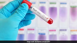 Nipah Spread Risk From India Low, No Need For Travel Or Trade Curbs: WHO