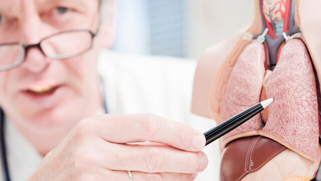 Lung cancer is one of the most common cancers worldwide