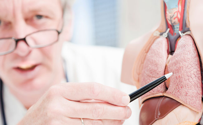 Lung cancer is one of the most common cancers worldwide
