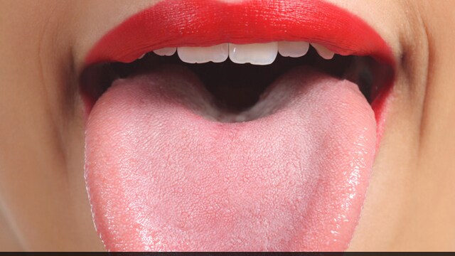 Black hairy tongue