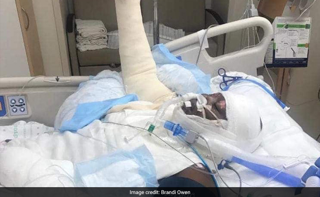 Internet 'Fire Challenge' Leaves 12-Year-Old Severely Burned