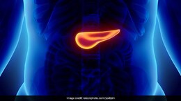 Why Is Pancreatic Cancer So Under-Diagnosed?