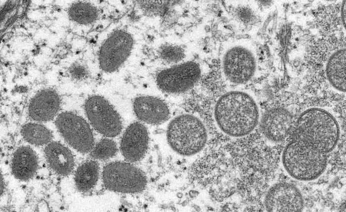 An electron microscopic image depicting a monkeypox virion.Source: CDC