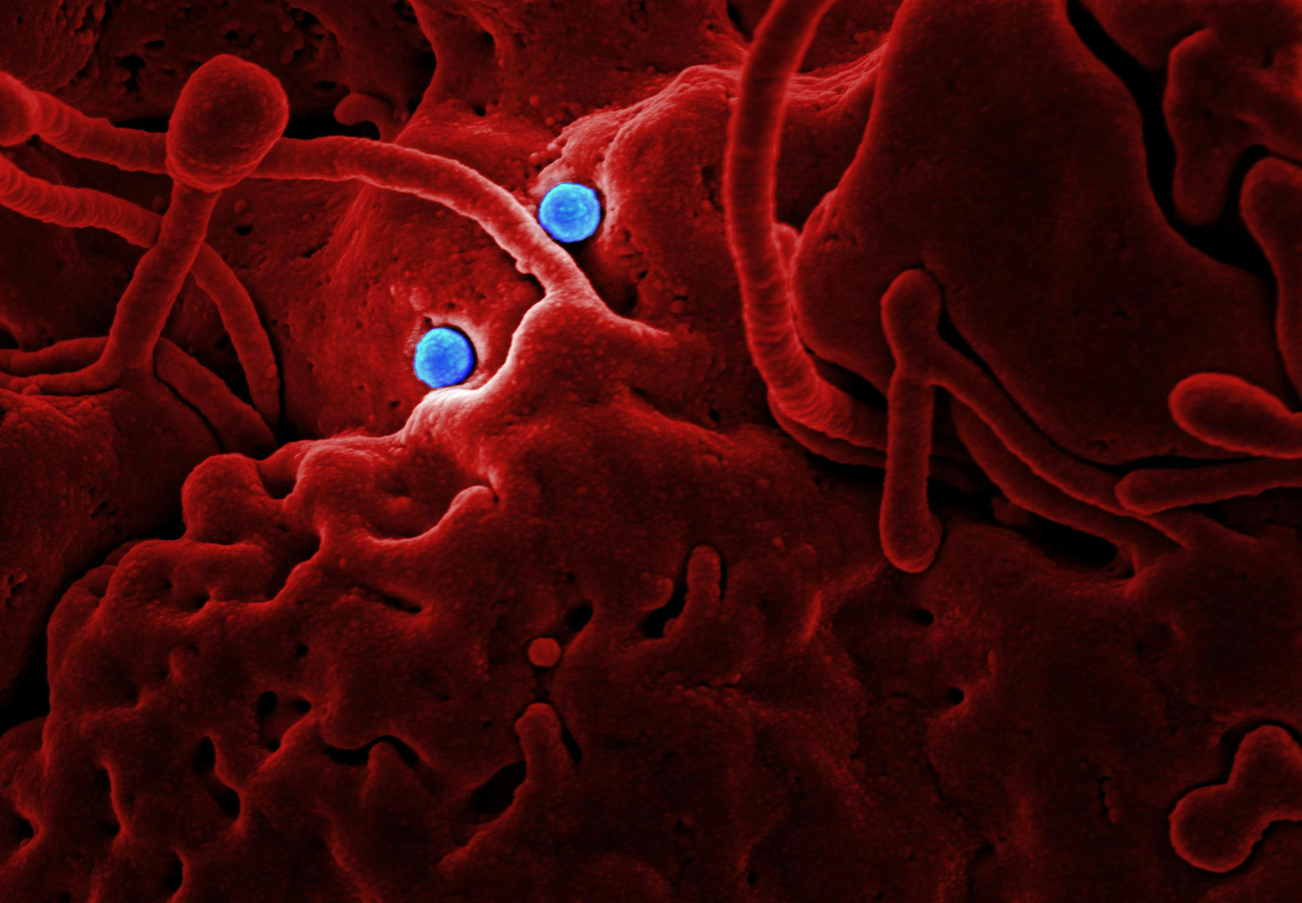Hyderabad-Based Research Centre, Tata Trust, Government Body To Screen Sickle Cell Anaemia