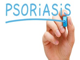 कुछ लोगों को क्यों हो जाता है सोरायसिस, एक्सपर्ट से जानिए क्या हैं सोरायसिस के कारण कुछ लोगों को क्यों हो जाता है सोरायसिस, एक्सपर्ट से जानिए क्या हैं सोरायसिस के कारण