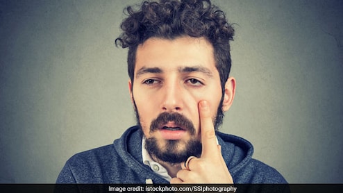 क्या सुबह उठते ही चेहरा सूजा हुआ नजर आता है? वजह सिर्फ नमक नहीं, शरीर दे रहा है ये 4 संकेत