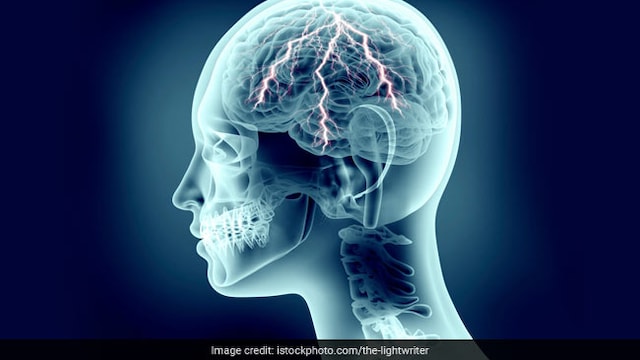 Both restrictive and obstructive lung diseases have been associated with dementia: study