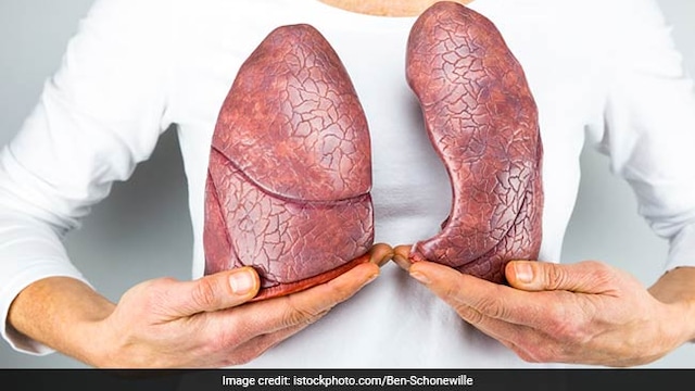 Lung cancer: Family history of lung cancer can increase your risk of developing it