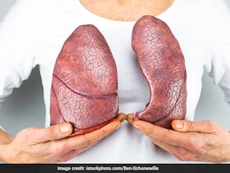 Lung Cancer Day: शरीर के ये 7 संकेत बताते हैं कि आपको है फेफड़ों का कैंसर, बिना देर किए डॉक्टर से मिलें Lung Cancer Day: शरीर के ये 7 संकेत बताते हैं कि आपको है फेफड़ों का कैंसर, बिना देर किए डॉक्टर से मिलें