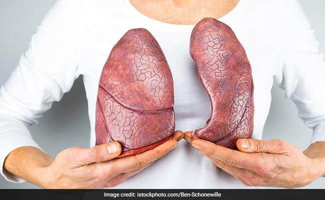 Lung cancer: Family history of lung cancer can increase your risk of developing it
