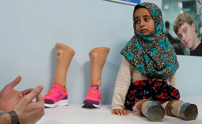A Syrian Girl Used Tin Cans For Legs. Now She Is Taking Her First Steps
