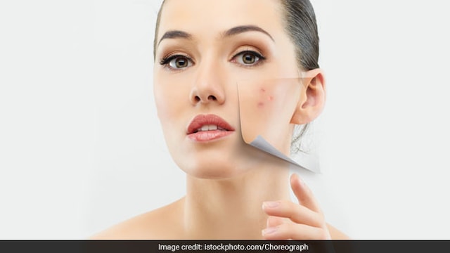 Remove make-up before going for a workout to prevent acne and clogged pores