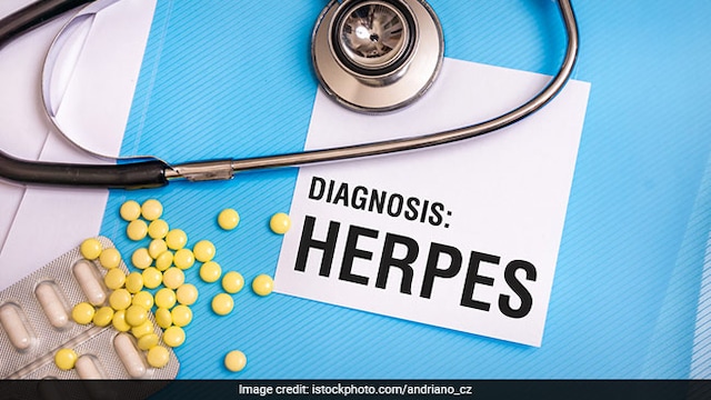 Herpes viruses - Recent study