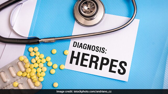 Herpes viruses - Recent study