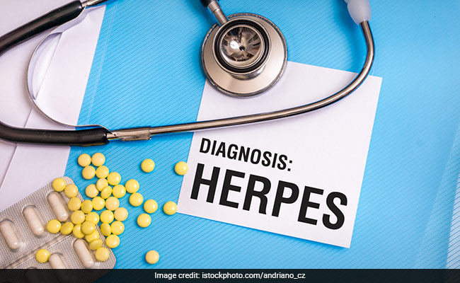 Herpes viruses - Recent study