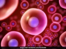 क्या स्टेम सेल थेरेपी से ठीक हो सकता है टाइप 1 डायबिटीज? जानिए चीन की अहम केस स्टडी में चौंकाने वाला नया दावा