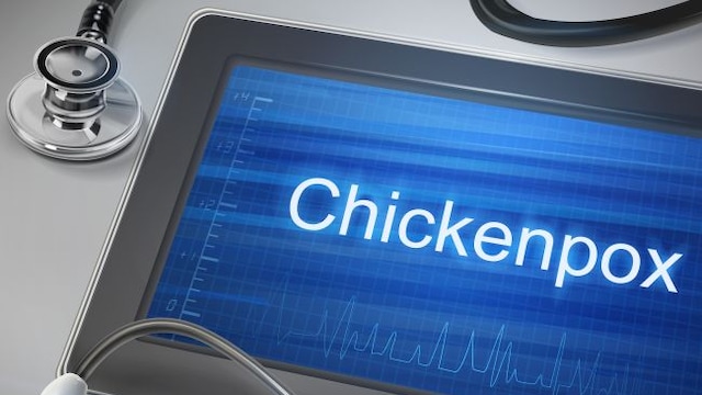 Most cases of chickenpox occur through the contact with an infected person.