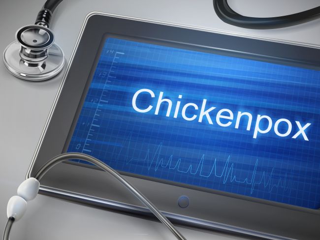 Most cases of chickenpox occur through the contact with an infected person.