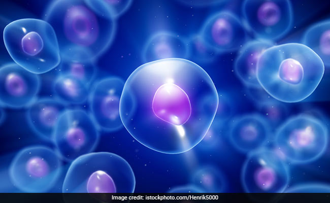 Man Becomes 3rd Patient To Be Cured Of HIV After Stem Cell Transplant