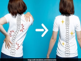 Non-Surgical Treatments To Tackle Scoliosis Non-Surgical Treatments To Tackle Scoliosis