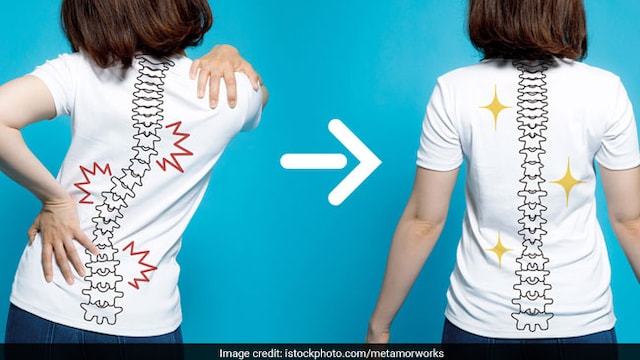 Exercising regularly is a non-surgical treatment for tackling scoliosis