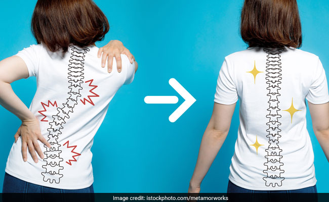 Exercising regularly is a non-surgical treatment for tackling scoliosis