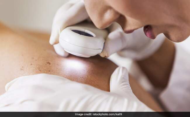 अब चोट पर पट्टी की जगह लगेगी ई-स्किन, करेगी खुद का इलाज...!