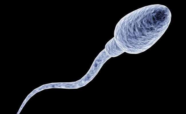 Hyperspermia is a condition in which a man produces more semen than is usual