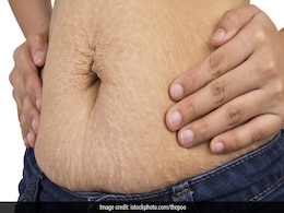 Pregnancy stretch mark हटाने के लिए Aloe Vera gel में इस पीले मसाले को मिलाकर लगाएं लेप, गायब हो जाएंगे निशान Pregnancy stretch mark हटाने के लिए Aloe Vera gel में इस पीले मसाले को मिलाकर लगाएं लेप, गायब हो जाएंगे निशान