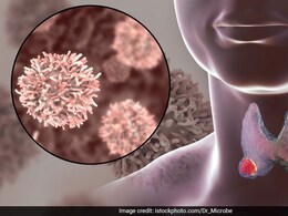 Thyroid Cancer Month 2025: किन्हें होता है थायराइड कैंसर का सबसे ज्यादा खतरा, जानें क्या हैं लक्षण  Thyroid Cancer Month 2025: किन्हें होता है थायराइड कैंसर का सबसे ज्यादा खतरा, जानें क्या हैं लक्षण