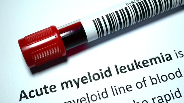 Acute Myeloid Leukemia does not have any cure