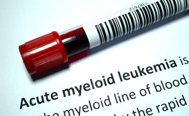 Acute Myeloid Leukemia does not have any cure