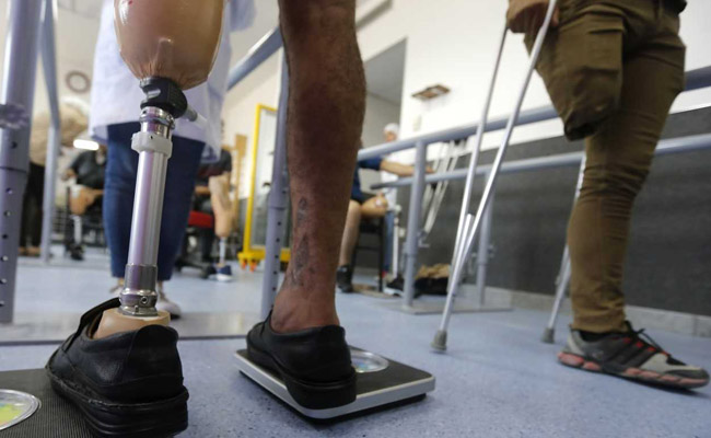 Syrian Made Prosthetics Will Make Damascus' War Amputees Walk Again