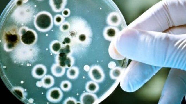 Bacterial cells infected by viruses, molecular memories are stored in special regions of bacterial DNA.