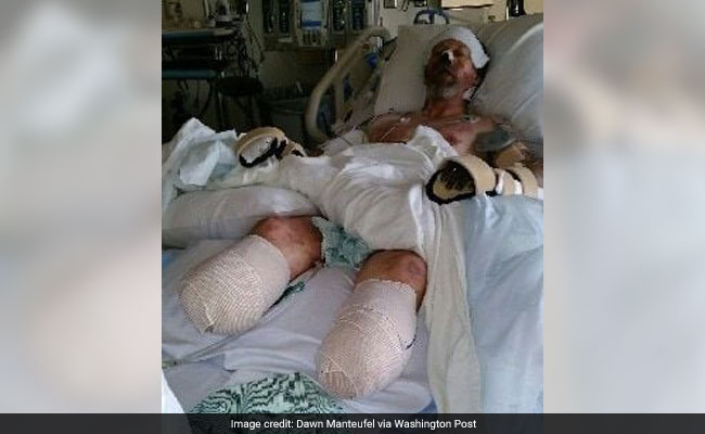 His Legs And Hands Had To Be Amputated. The Shocking Reason...