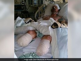 जानें क्या है सेप्सिस? लक्षण, कारण, निदान, प्रकार, उपचार