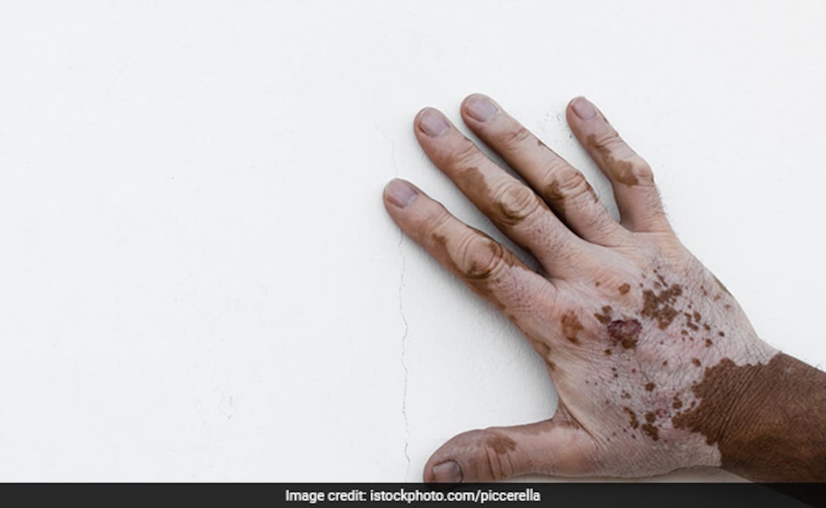 Latest and Breaking News on NDTV Latest and Breaking News on NDTV