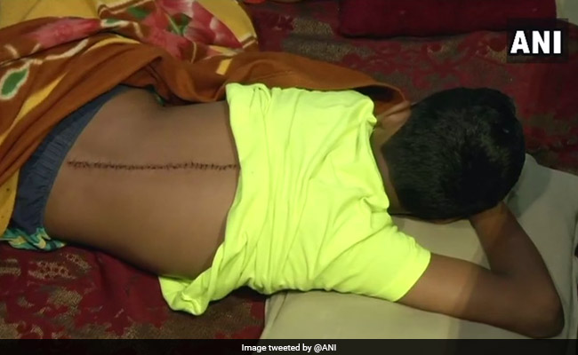7th Grader Has Stitches From Neck To Back, Attacked In School With Blade