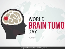 World Brain Tumor Day 2023:  ब्रेन ट्यूमर के इन रिस्क फैक्टर्स को बिल्कुल भी ना करें नजरअंदाज, अभी से ही हो जाएं सावधान वर्ना ये बीमारी बन सकती है 'जानलेवा' World Brain Tumor Day 2023:  ब्रेन ट्यूमर के इन रिस्क फैक्टर्स को बिल्कुल भी ना करें नजरअंदाज, अभी से ही हो जाएं सावधान वर्ना ये बीमारी बन सकती है 'जानलेवा'