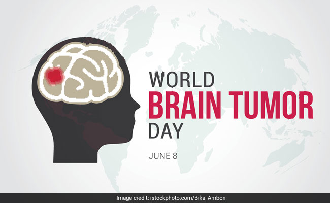 World Brain Tumor Day 2018 aims at helping brain tumor patients with medical assitance